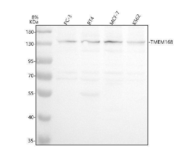 a17219 1 tmem168 primary antibodies wb testing 1
