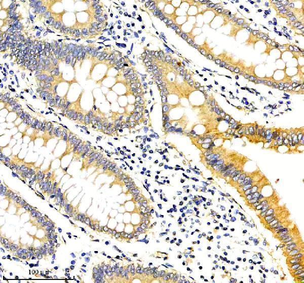 a17241 1 tmem232 primary antibodies ihc testing 2