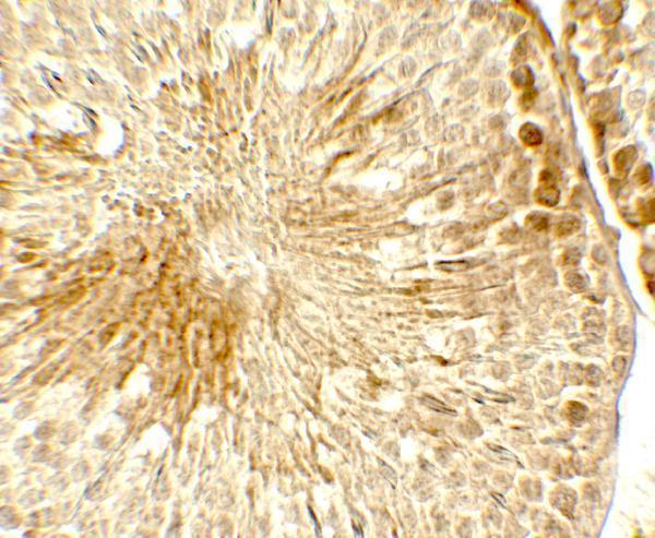 a17257 topaz1 primary antibodies ihc testing 2