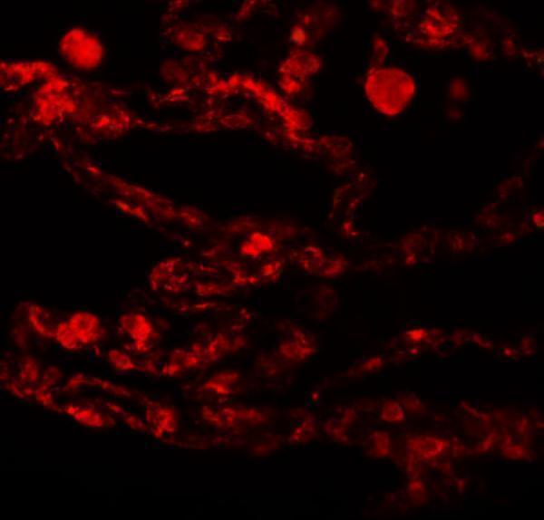a17261 ccdc69 primary antibodies if testing 5