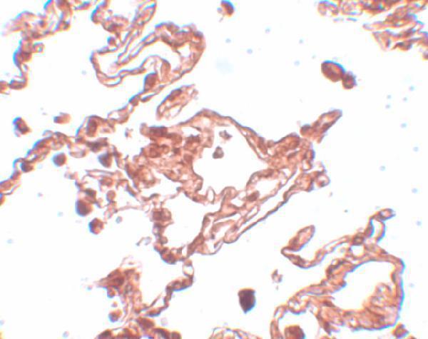 a17261 ccdc69 primary antibodies ihc testing 4