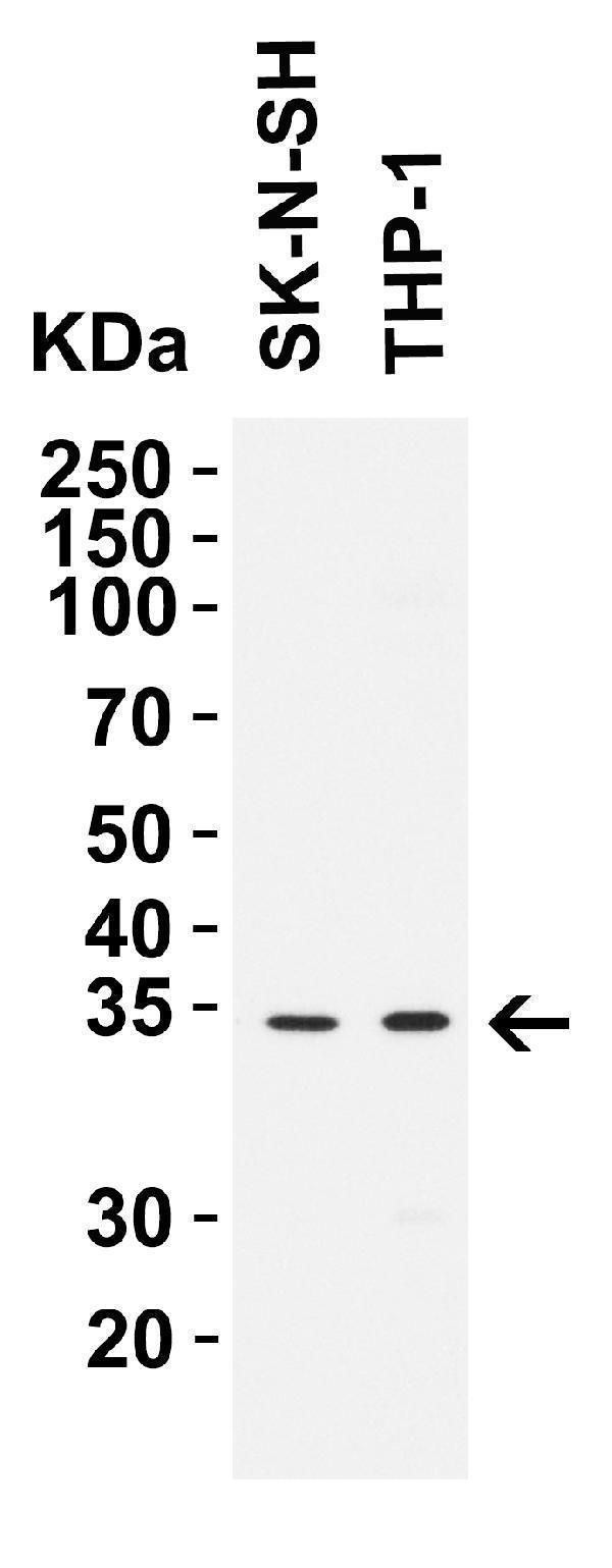 WB Validation in Human Cell Lines
Loading: 15 μg of lysate
