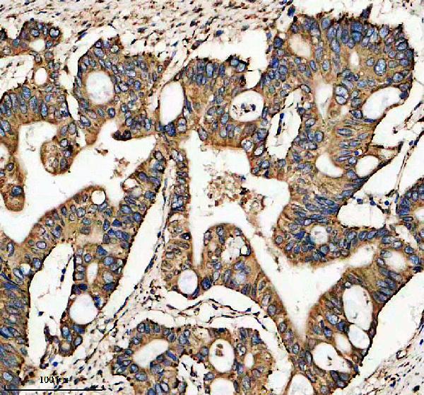 IHC analysis of METTL7B using anti-METTL7B antibody (A17310-1)