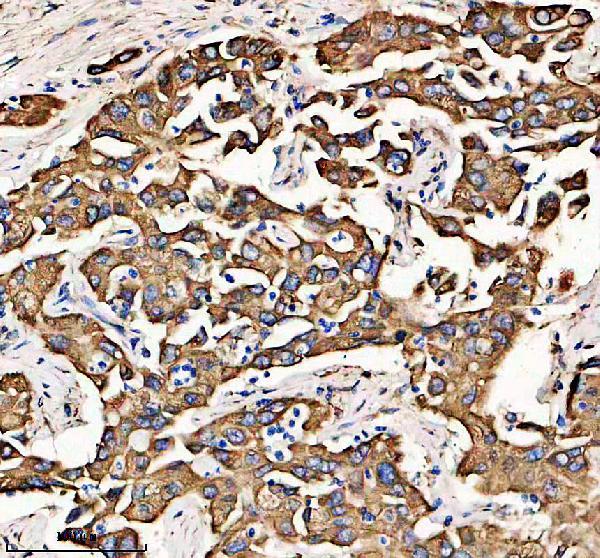 IHC analysis of METTL7B using anti-METTL7B antibody (A17310-1)