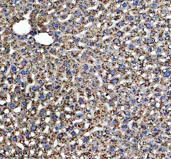 a17310 1 mettl7b primary antibodies ihc testing 3