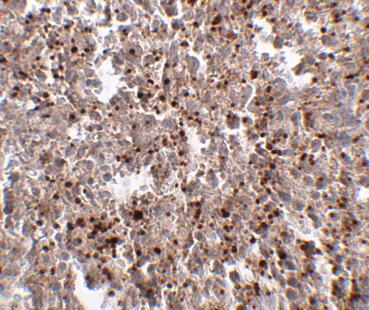 a17310 mettl7b primary antibodies ihc testing 2
