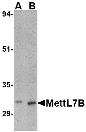 a17310 mettl7b primary antibodies wb testing 1