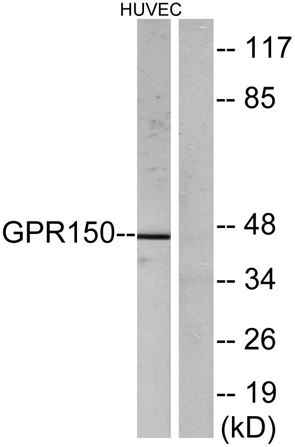 Western blot analysis of lysates from HUVEC cells, using GPR150 Antibody