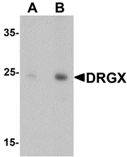 a17321 drgx primary antibodies wb testing 1
