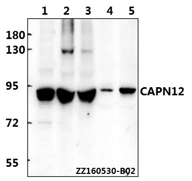 Western blot (WB) analysis of CAPN12 polyclonal antibody at 1:500 dilution
Lane1:A549 whole cell lysate(40ug)
Lane2:Jurkat whole cell lysate(40ug)
Lane3:THP-1 whole cell lysate(40ug)
Lane4:The lung tissue lysate of Mouse(40ug)
Lane5:The lung tissue lysate of Fetal Rat(40ug)