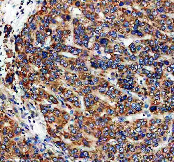 a17328 1 echdc2 primary antibodies ihc testing 1