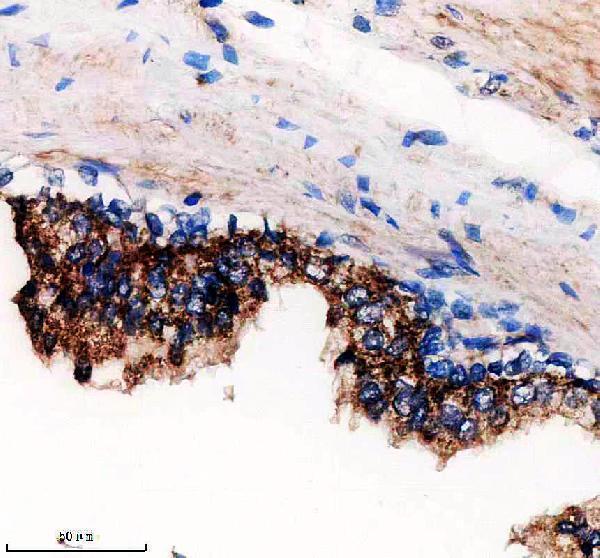a17328 1 echdc2 primary antibodies ihc testing 2