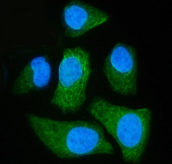 Figure 5. IF analysis of SLC25A51/52 using anti-SLC25A51/52 antibody (A17353). SLC25A51/52 was detected in an immunocytochemical section of Hela cells. Enzyme antigen retrieval was performed using IHC enzyme antigen retrieval reagent (AR0022) for 15 mins. The cells were blocked with 10% goat serum. And then incubated with 5 microg/mL rabbit anti-SLC25A51/52 Antibody (A17353) overnight at 4°C. DyLight®488 Conjugated Goat Anti-Rabbit IgG (BA1127) was used as secondary antibody at 1:100 dilution and incubated for 30 minutes at 37°C. The section was counterstained with DAPI. Visualize using a fluorescence microscope and filter sets appropriate for the label used.