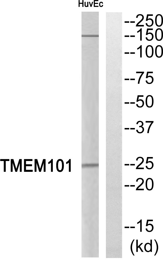 Western blot analysis of TMEM101 Antibody