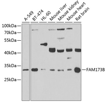 a17438 fam173b primary antiboties wb testing 1