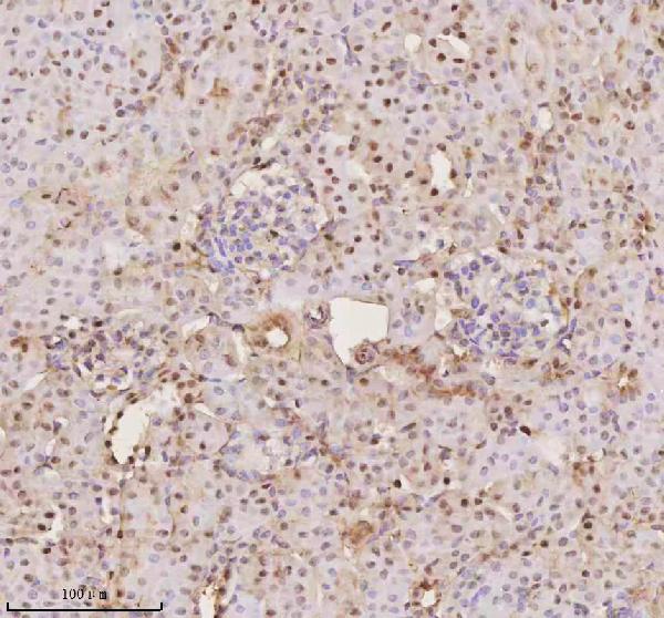 Figure 3. IHC analysis of PTRHD1 using anti-PTRHD1 antibody (A17455). PTRHD1 was detected in a paraffin-embedded section of mouse kidney tissue. Heat mediated antigen retrieval was performed in EDTA buffer (pH 8.0, epitope retrieval solution). The tissue section was blocked with 10% goat serum. The tissue section was then incubated with 2 microg/ml rabbit anti-PTRHD1 Antibody (A17455) overnight at 4°C. Peroxidase Conjugated Goat Anti-rabbit IgG was used as secondary antibody and incubated for 30 minutes at 37°C. The tissue section was developed using HRP Conjugated Rabbit IgG Super Vision Assay Kit (Catalog # SV0002) with DAB as the chromogen.