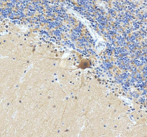 IHC analysis of C2orf79/PTRHD1 using anti-C2orf79/PTRHD1 antibody (A17455)