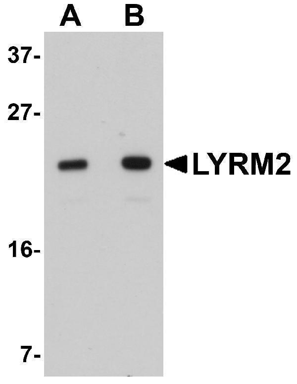 Western blot analysis of LYRM2 in A549 cell lysate with LYRM2 antibody at (A) 1 and (B) 2 μg/mL