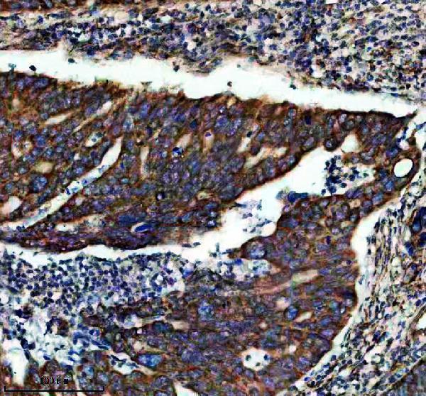 IHC analysis of FAM83F using anti-FAM83F antibody (A17465-1)