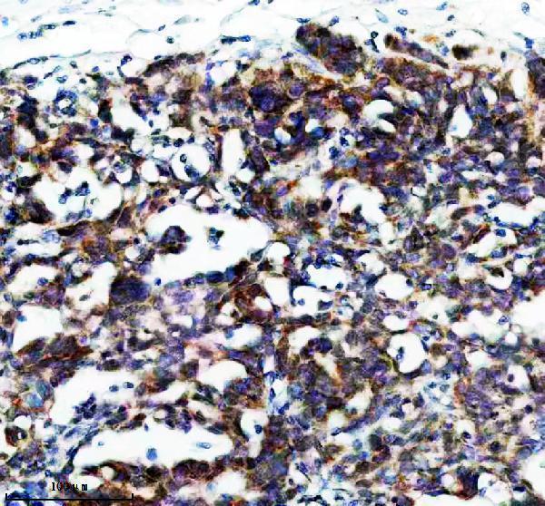 IHC analysis of FAM83F using anti-FAM83F antibody (A17465-1)