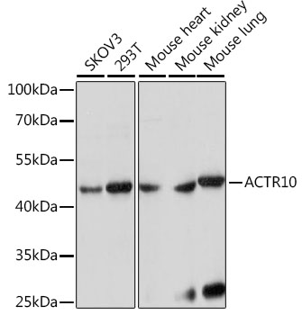 Western blot analysis of extracts of various cell lines, using ACTR10 antibody  at 1:1000 dilution