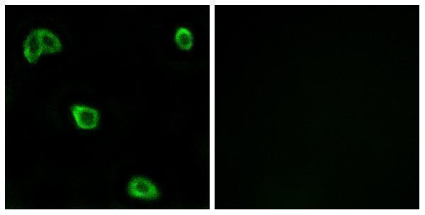 a17529 or10k1 primary antibodies if testing 1