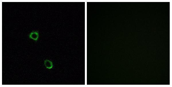a17539 or2m2 primary antibodies if testing 1