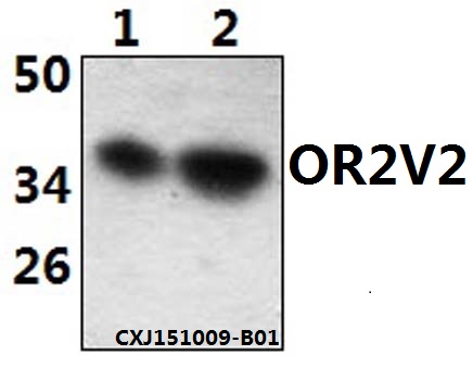 Western blot (WB) analysis of OR2V2 polyclonal antibodyat 1:500 dilution
Lane1:Hela whole cell lysate(40ug)
Lane2:Jurkat whole cell lysate(40ug)