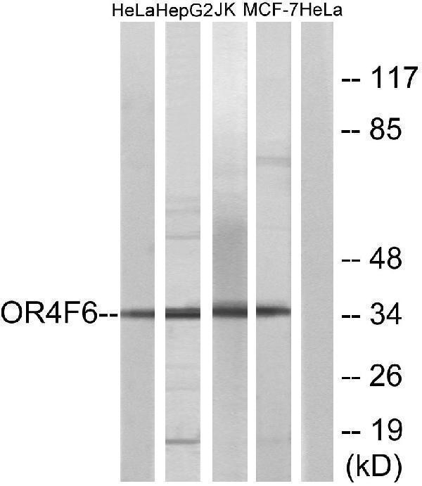 Western blot analysis of lysates from HeLa, Jurkat, HepG2, and MCF-7 cells, using OR4F6 Antibody