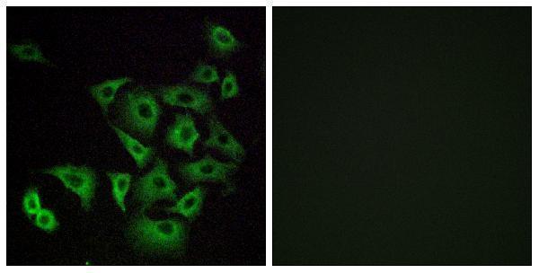 a17551 or4k14 primary antibodies if testing 1
