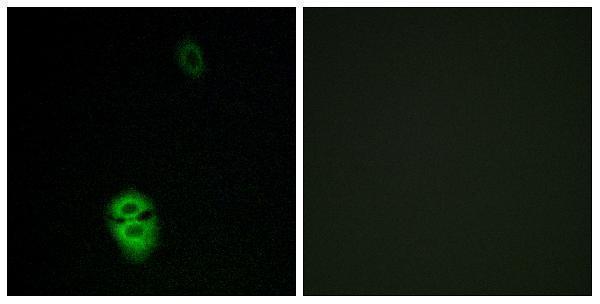 a17552 or4k17 primary antibodies if testing 1