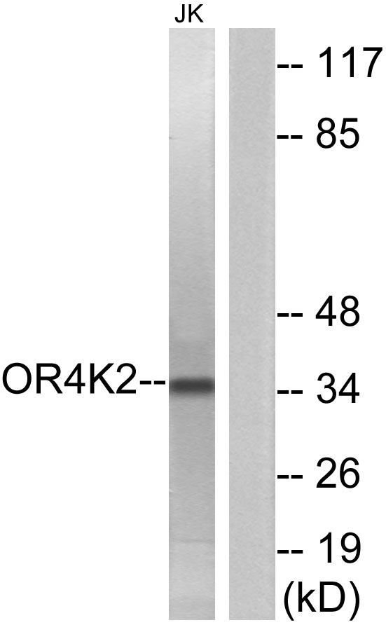 Western blot analysis of lysates from Jurkat cells, using OR4K2 Antibody