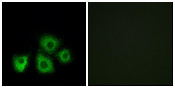a17570 1 or5m1 primary antibodies if testing 1