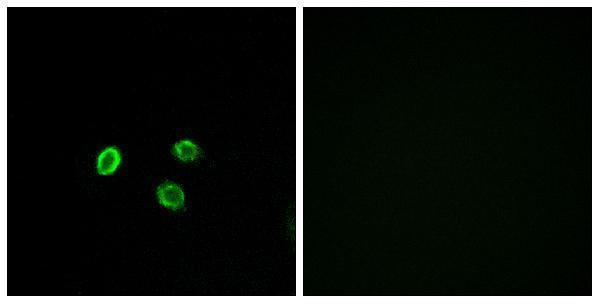 a17571 or5m9 primary antibodies if testing 1