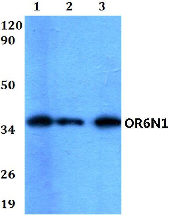a17578 or6n1 primary antiboties wb testing 1