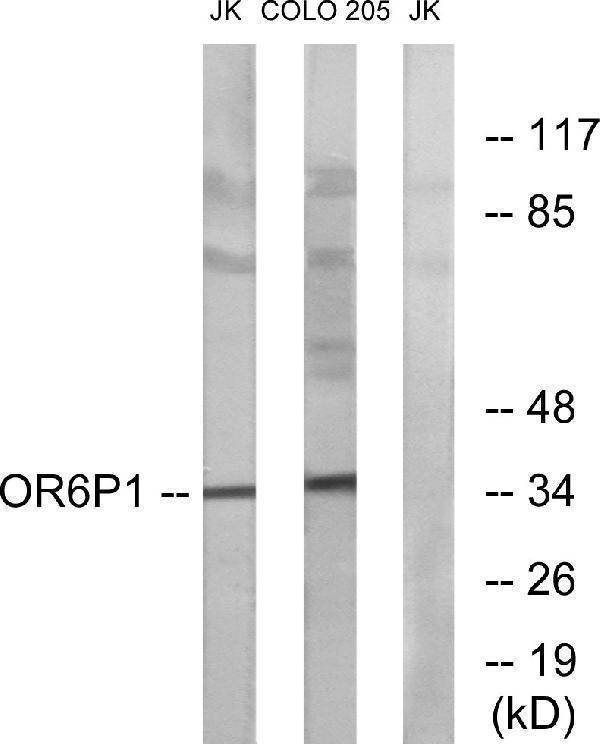 Western blot analysis of lysates from Jurkat and COLO cells, using OR6P1 Antibody