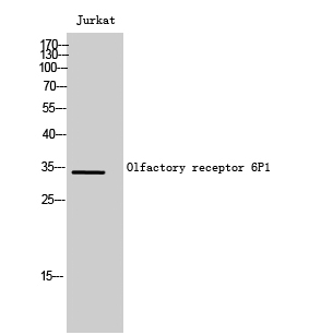 Western Blot analysis of Jurkat cells using Olfactory receptor 6P1 Polyclonal Antibody