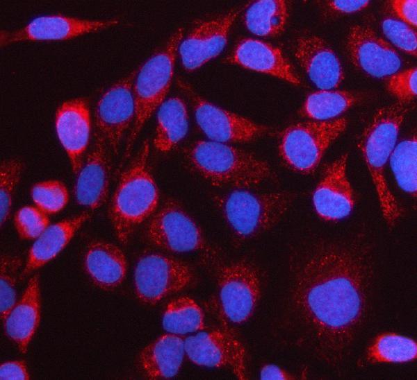 Figure 3. IF analysis of NTN3 using anti-NTN3 antibody (A17692). NTN3 was detected in an immunocytochemical section of HELA cells. Enzyme antigen retrieval was performed using IHC enzyme antigen retrieval reagent (AR0022) for 15 mins. The cells were blocked with 10% goat serum. And then incubated with 5 microg/mL rabbit anti-NTN3 Antibody (A17692) overnight at 4°C. Cy3 Conjugated Goat Anti-Rabbit IgG (BA1032) was used as secondary antibody at 1:500 dilution and incubated for 30 minutes at 37°C. The section was counterstained with DAPI. Visualize using a fluorescence microscope and filter sets appropriate for the label used.
