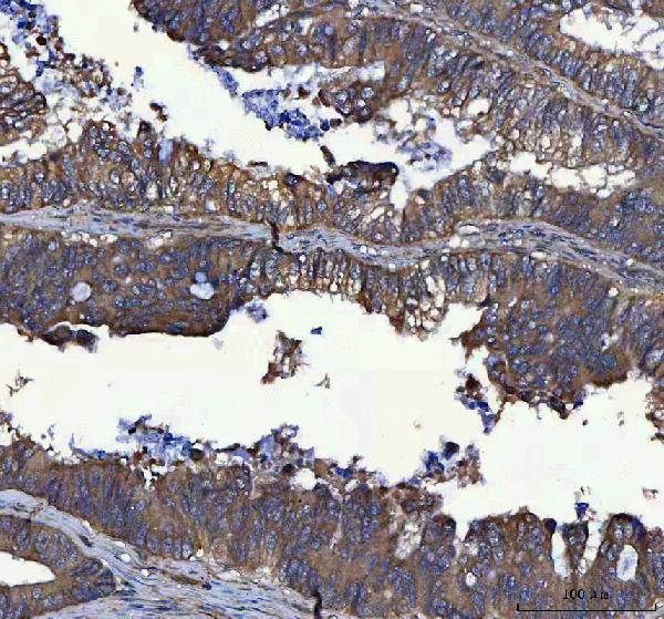  IHC analysis of MSLNL using anti-MSLNL antibody (A17693)