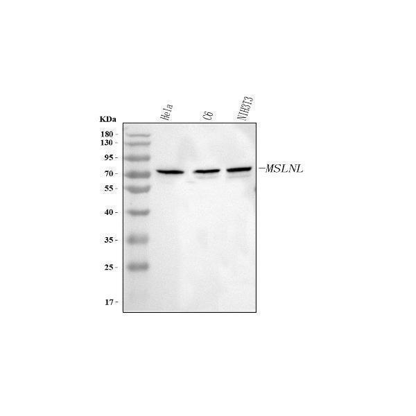  Western blot analysis of MSLNL using anti-MSLNL antibody (A17693)