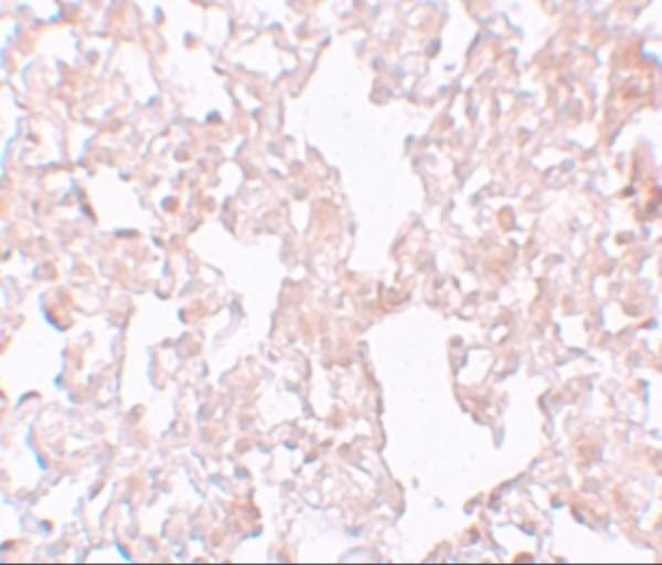 Immunohistochemistry of MFSD1 in rat lung tissue with MFSD1 antibody at 10 μg/mL