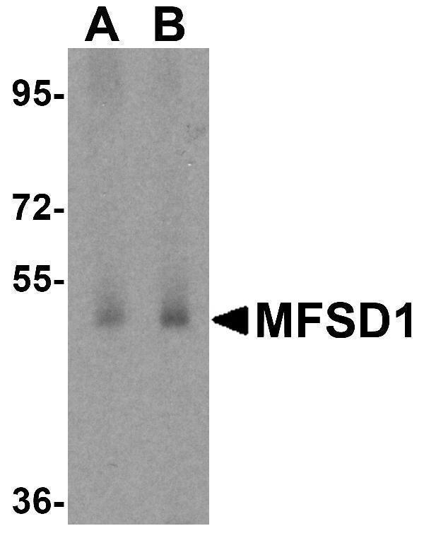 Western blot analysis of MFSD1 in human testis tissue lysate with MFSD1 antibody at (A) 1 and (B) 2 μg/mL