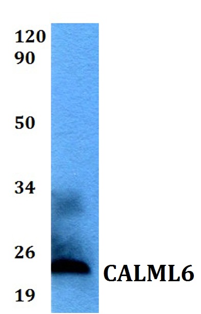 Western blot (WB) analysis of CALML6 polyclonal antibody at 1:500 dilution
Lane1:MCF-7 whole cell lysate