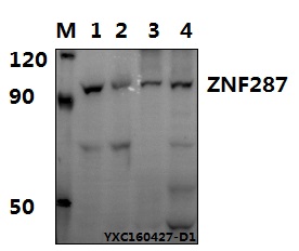 Western blot (WB) analysis of ZNF287 polyclonal antibody at 1:500 dillution
Lane1:HEK293T whole cell lysate(40μg)
Lane2:A549 whole cell lysate(40μg)
Lane3:The Brain tissue lysate of Rat (40μg)
Lane4:The Brain tissue lysate of Mouse(40μg)