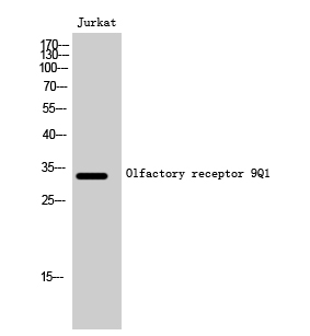 Western Blot analysis of Jurkat cells using Olfactory receptor 9Q1 Polyclonal Antibody