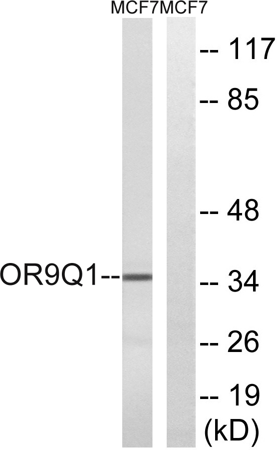 Western blot analysis of lysates from MCF-7 cells, using OR9Q1 Antibody