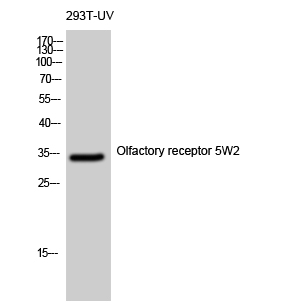 Western Blot analysis of 293T-UV cells using Olfactory receptor 5W2 Polyclonal Antibody diluted at 1:500