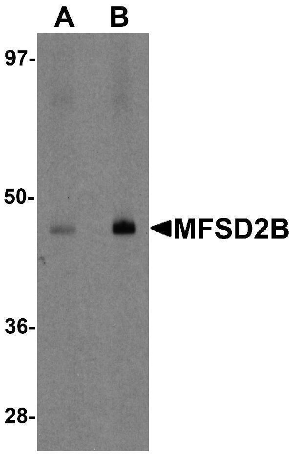 a17784 mfsd2b primary antibodies wb testing 1