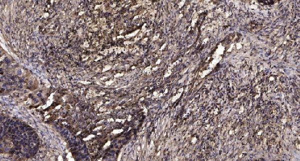 a17802 c18orf8 primary antibodies ihc testing 1