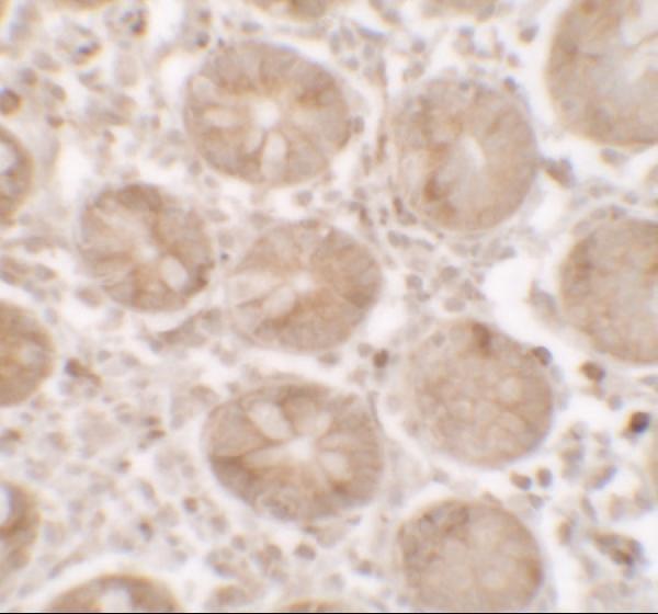 a17840 shisa3 primary antibodies ihc testing 2